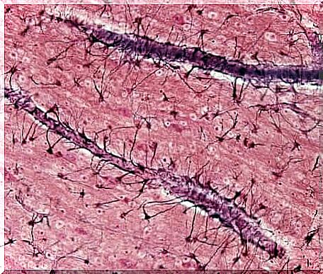 An image of astrocytes.